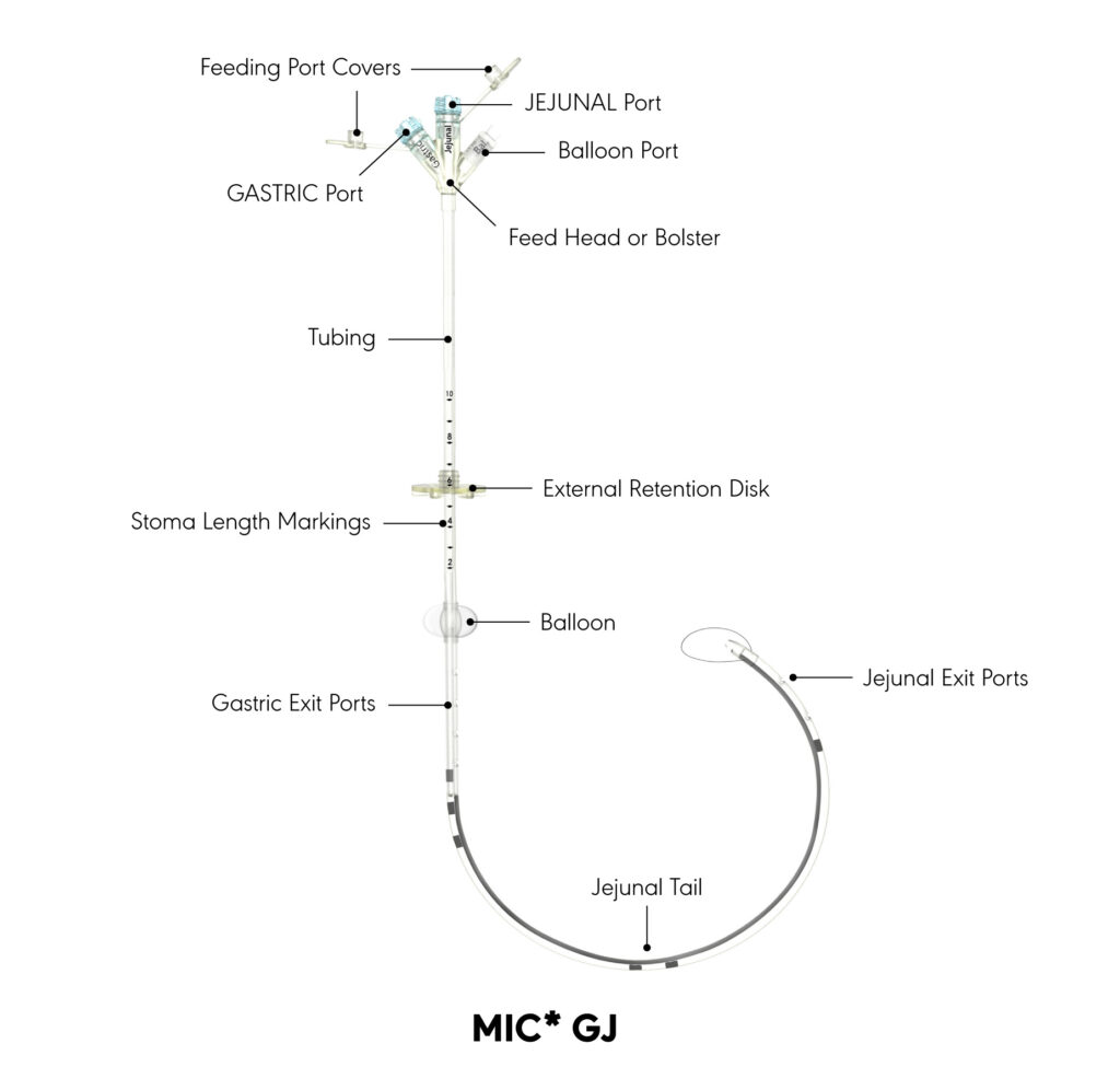 MIC* GJ product diagram