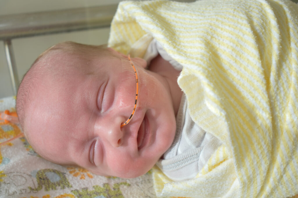 NG Tube What to Expect After Procedure